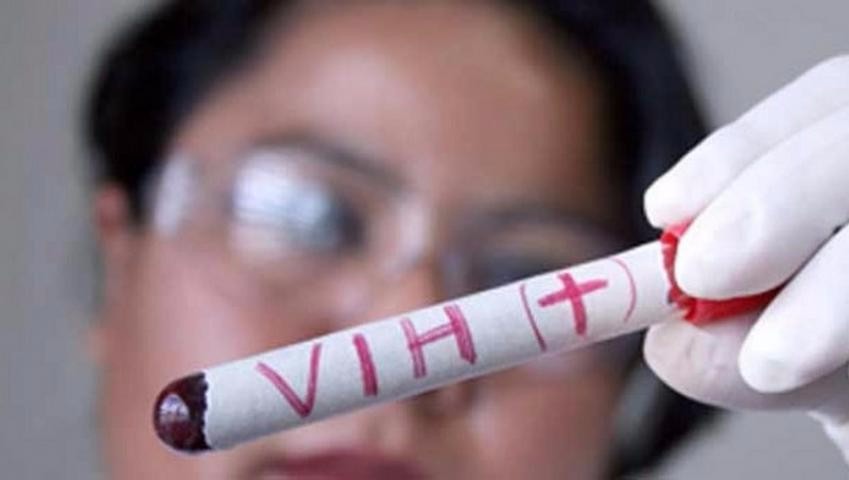 Diputados piden reducir trabas para que jóvenes accedan a examen de VIH 